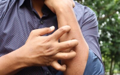 Recognizing Osteoarthritis Symptoms Before It Gets Worse